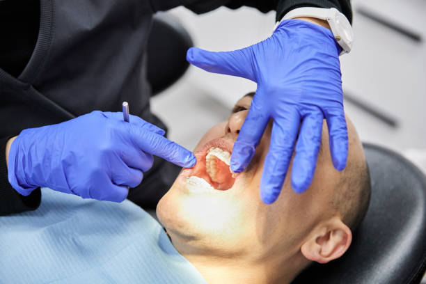 Dentist for Dental Trauma in ID